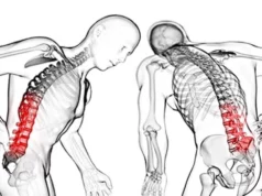 Ankilozan Spondilit Malulen Emeklilik Şartları 2026 Ankilozan Spondilit Malulen Emeklilik Şartları
